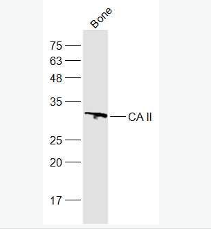 Anti-CA II antibody-碳酸酐酶2抗体