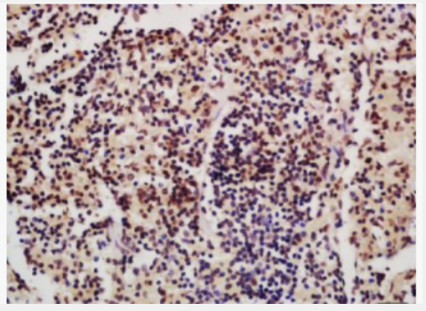 Anti-IRF4 antibody-干扰素调节因子4抗体