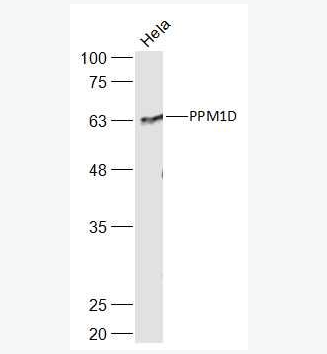 Anti-PPM1D antibody-原癌基因WIP1抗体