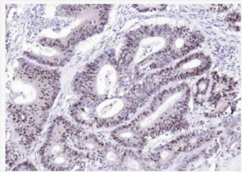 Anti-HCMV pp65 antibody-巨细胞病毒PP65/CMV低基质磷脂蛋白抗体