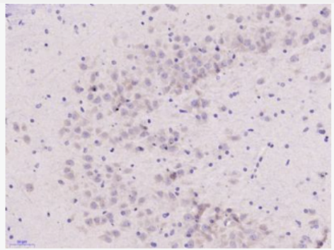 Anti-IL17E antibody-白介素-17E/白介素25抗体