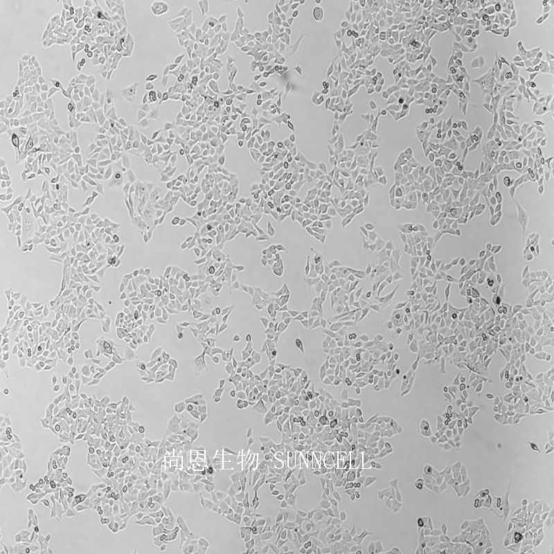 小鼠黑色素瘤细胞