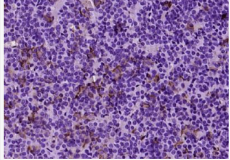 Anti-TSHB  antibody-促甲状腺素β亚单位抗体