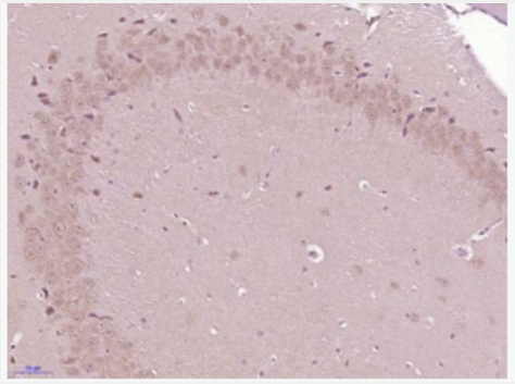 Anti-Phospho-Glycogen synthase 1 (Ser641) antibody-磷酸化葡萄糖合成酶1抗体