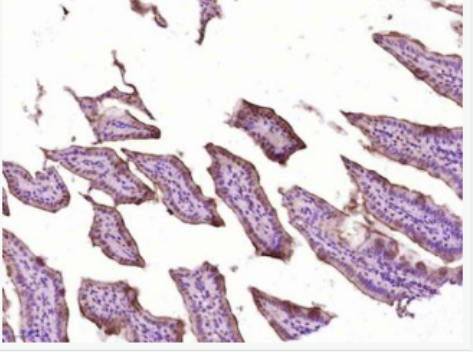Anti-pPhospho-IKK alpha (Ser180) + IKK beta (Ser181) antibody-磷酸化KB抑制蛋白激酶α/β抗体