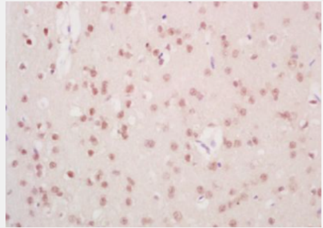 Anti-Mre11 antibody-DNA损伤关键蛋白Mre11抗体