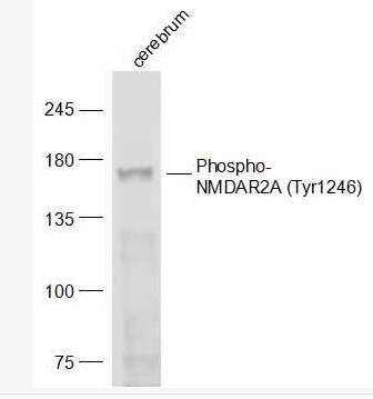 Anti-Phospho-NMDAR2A (Tyr1246) antibody-磷酸化谷氨酸受体2A抗体