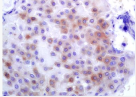 Anti-PLK1 antibody-丝氨酸/苏氨酸蛋白激酶PLK1抗体