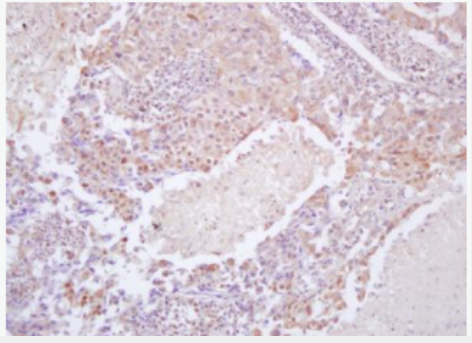 Anti-phospho-eIF4EBP1 (Thr37 + Thr46) antibody-磷酸化eIF4E结合蛋白1抗体