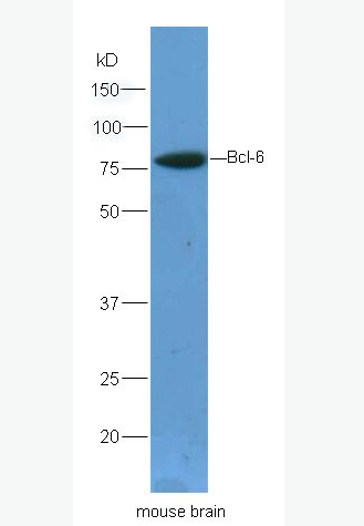 Anti-Bcl-6 antibody-原癌基因Bcl-6抗体