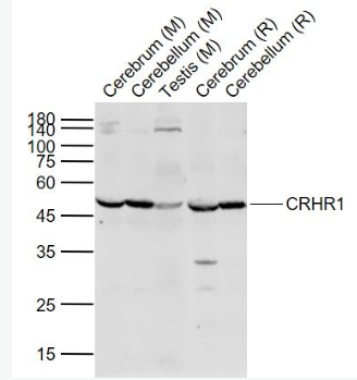 Anti-CRHR1 antibody-促肾上腺皮质释放激素受体1抗体