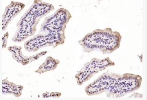 Anti-Phospho-Stat4 (Tyr693) antibody-磷酸化信号转导和转录激活因子4抗体