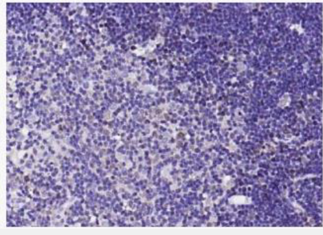 Anti-S100-A9 antibody-S100A9抗体