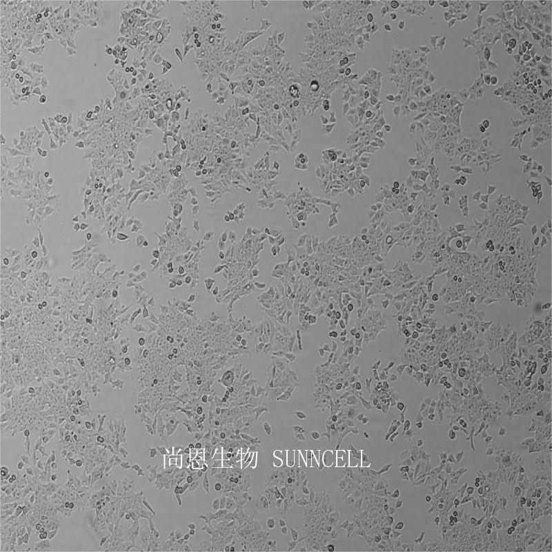 小鼠睾丸畸胎瘤细胞