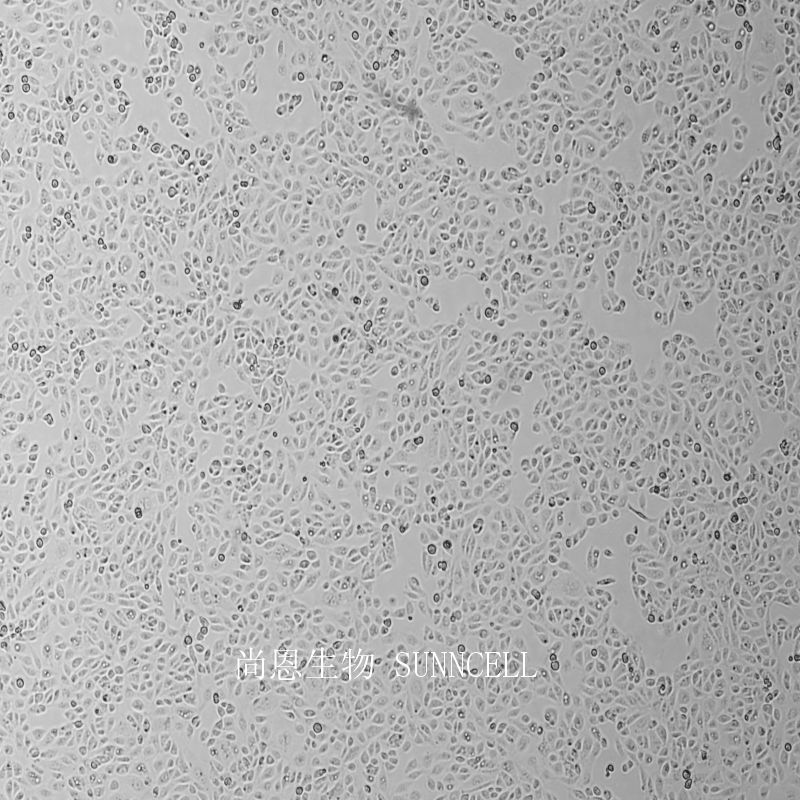 人肾小管上皮细胞