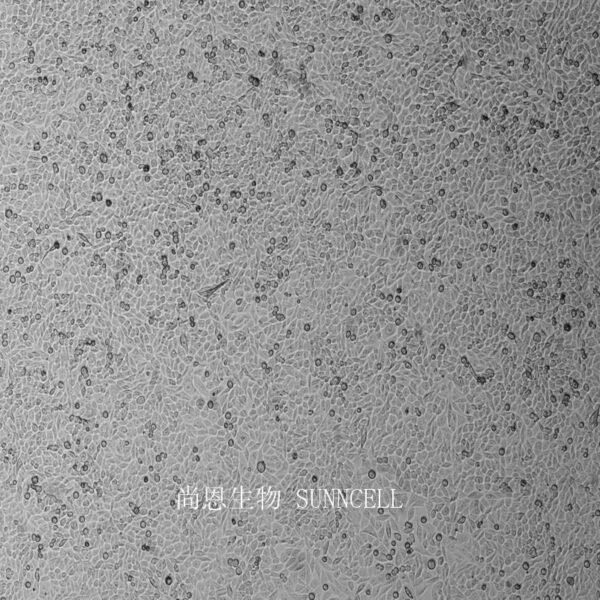 人前列腺癌高转移细胞