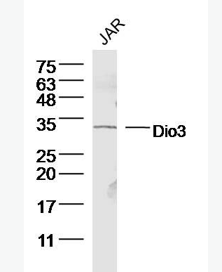 Anti-Dio3 antibody-甲状腺素5'脱碘酶3抗体