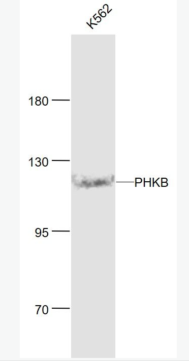 Anti-PHKB antibody-磷酸化酶β抗体