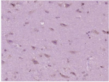 Anti-HLA Class 1 ABC/HLA ABC antibody-人类白细胞抗原A抗体