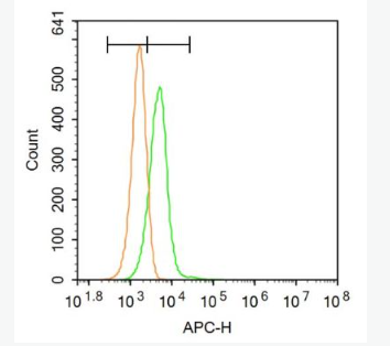 Anti-CPT1B antibody-肉毒碱棕榈酰基转移酶1B抗体