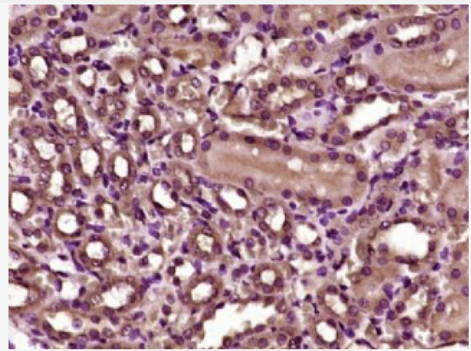 Anti-Villin antibody-绒毛蛋白抗体