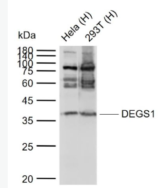 Anti-DEGS1 antibody-退行性精母细胞同源物1抗体