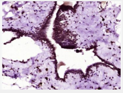 Anti-FABP4 antibody-脂肪细胞型脂肪酸结合蛋白抗体