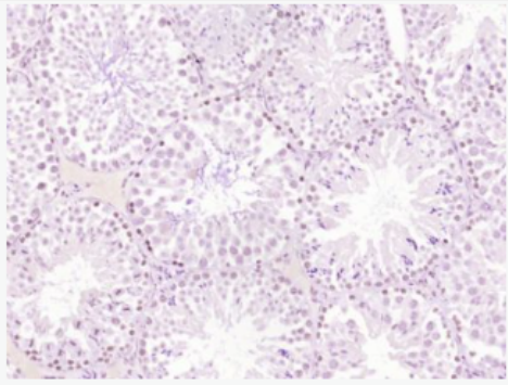 Anti-KLF9 antibody-转录因子KLF9抗体