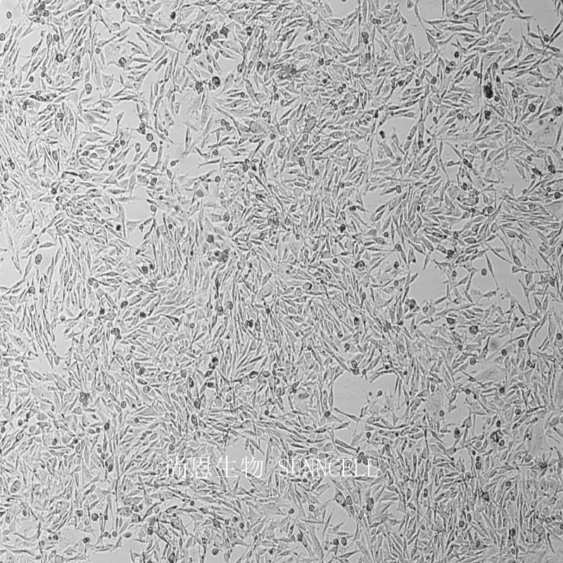 人眼脉络黑色素瘤细胞