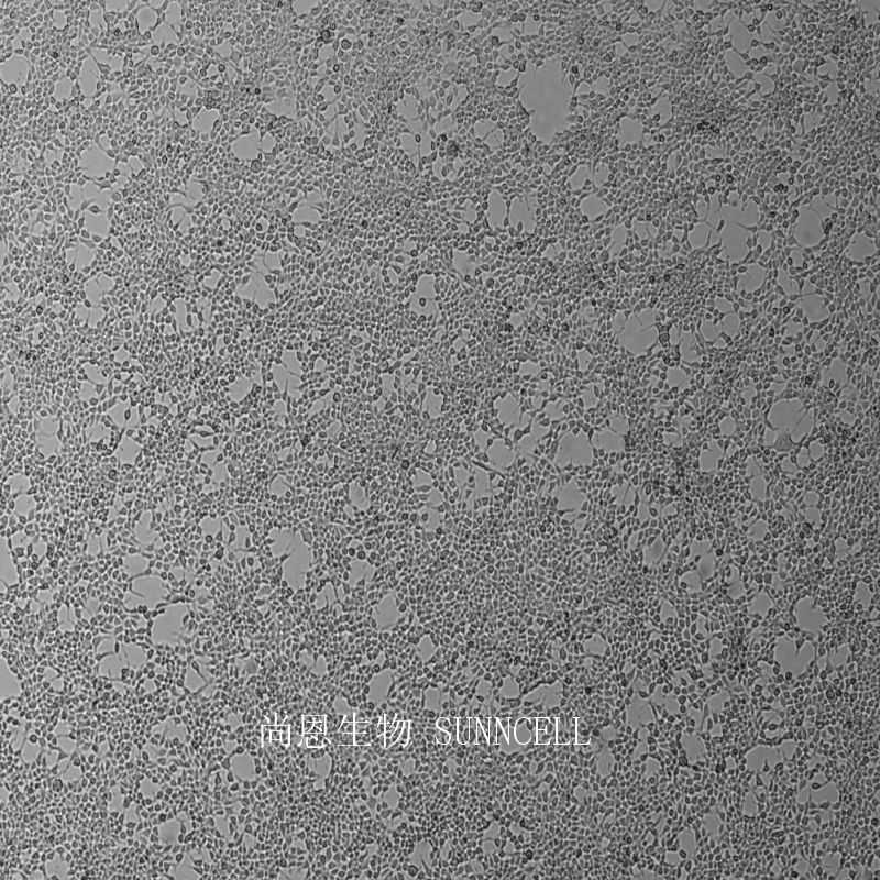 293人胚肾细胞