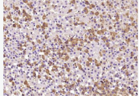 Anti-Seladin 1 antibody-24脱氢胆固醇还原酶抗体