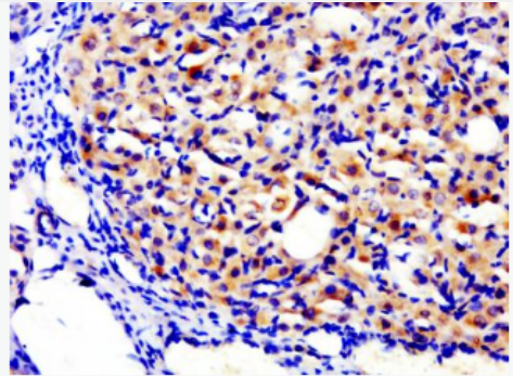 Anti-TG antibody-甲状腺球蛋白抗体