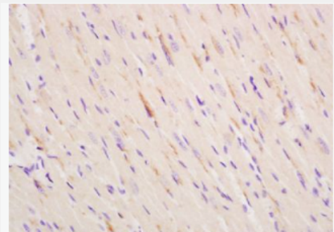 Anti-ITPR2  antibody-5-三磷酸肌醇受体2抗体