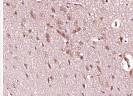 Anti-GLO1 antibody-乙二醛酶1抗体