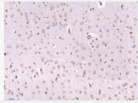 Anti-phospho-p53BP1 (Ser25 + Ser29) antibody-磷酸化p53结合蛋白1抗体