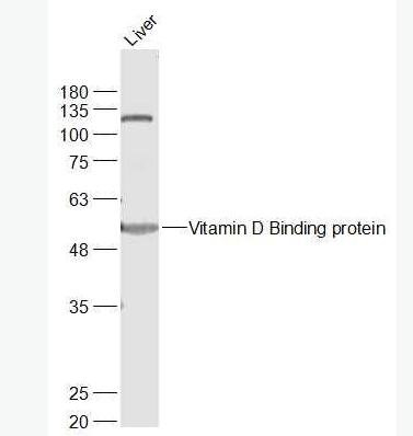 Anti-Vitamin D Binding protein antibody-维生素D结合蛋白抗体