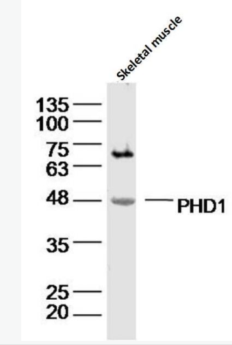 Anti-PHD1 antibody-脯氨酰羟化酶抗体