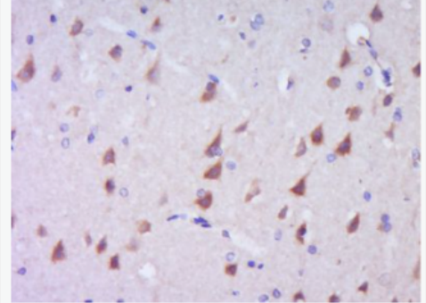 Anti-c-Kit/CD117 antibody-原癌基因蛋白c-kit（CD117）抗体