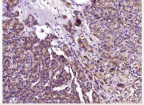Anti-SPINK1 antibody-肿瘤相关胰蛋白酶抑制剂1抗体