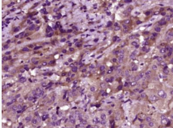 Anti-Phospho-MST1 (Thr183) antibody-磷酸化蛋白激酶MST1抗体