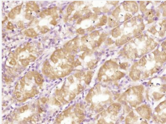 Anti-RELM beta antibody-抵抗素样分子β抗体