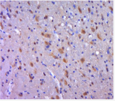 Anti-AIMP2  antibody-AIMP2抗体