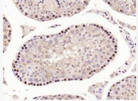 Anti-Collagen XI alpha 2  antibody-胶原蛋白11A2抗体