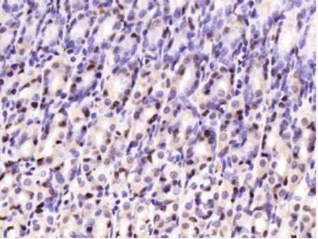 Anti-RBP4 antibody-视黄醇结合蛋白4抗体