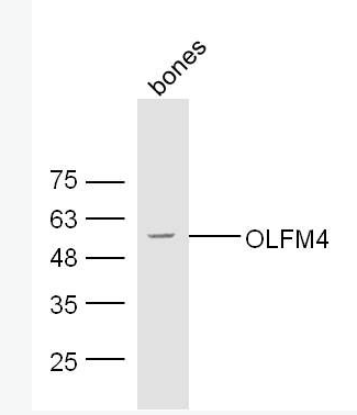 Anti-OLFM4 antibody-抗细胞凋亡蛋白OLFM44抗体