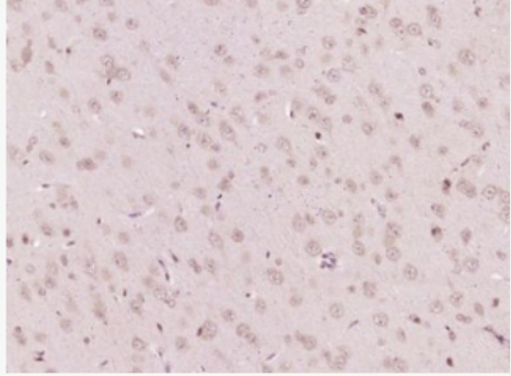 Anti-CIKS/TRAF3IP2 antibody-核因子NFκB激活蛋白1抗体