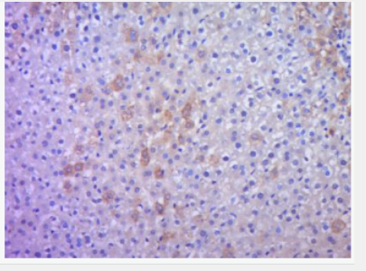 Anti-IHH antibody-HHG2抗体