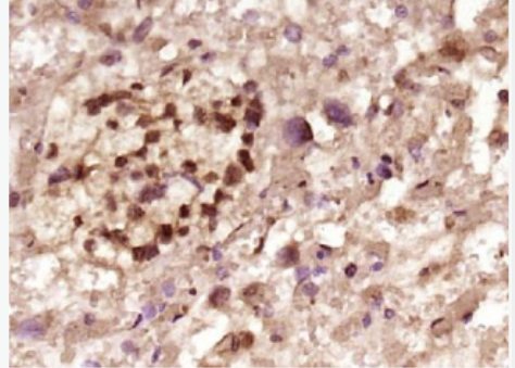 Anti-GATA2 antibody-GATA结合蛋白2抗体