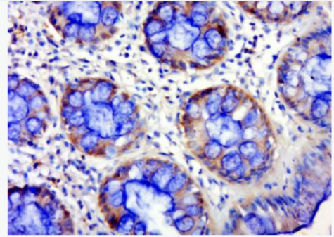 Anti-NPHS2 antibody-肾小球裂孔膜蛋白PDCN抗体