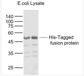 Anti-His Tag antibody-His Tag标签抗体